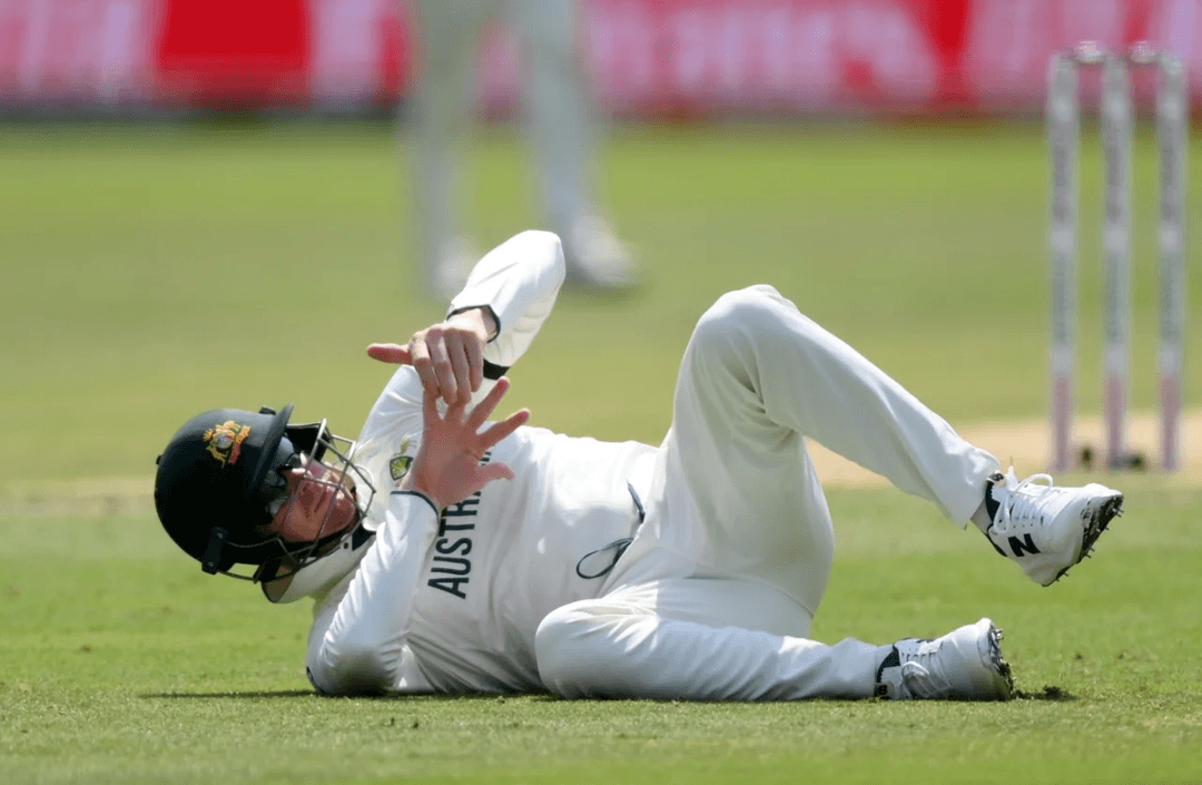 Steve Smith Injured 